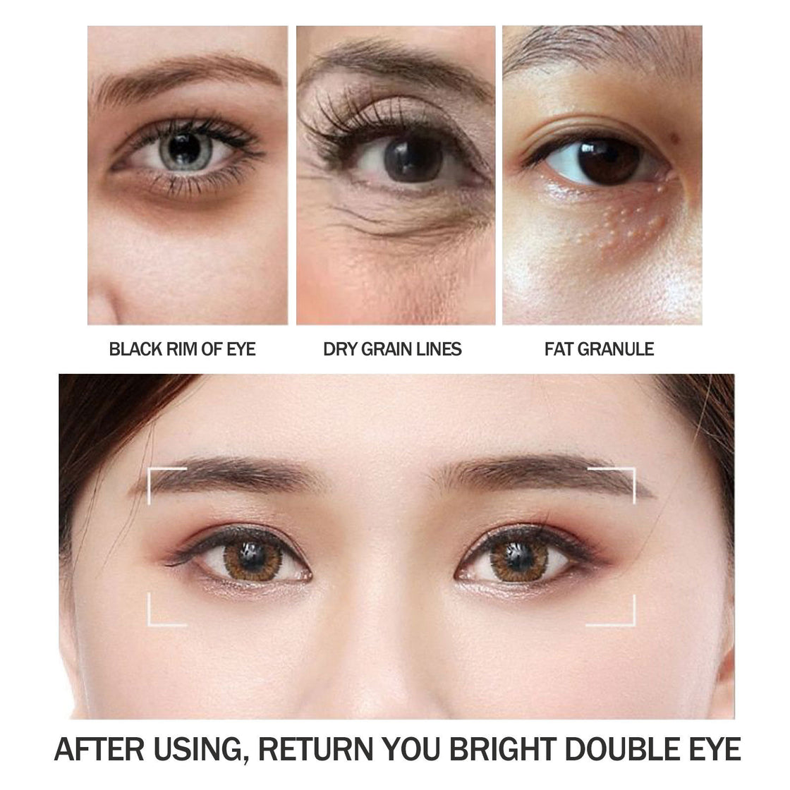 Remove Fat Particles Moisturizing Eye Cream