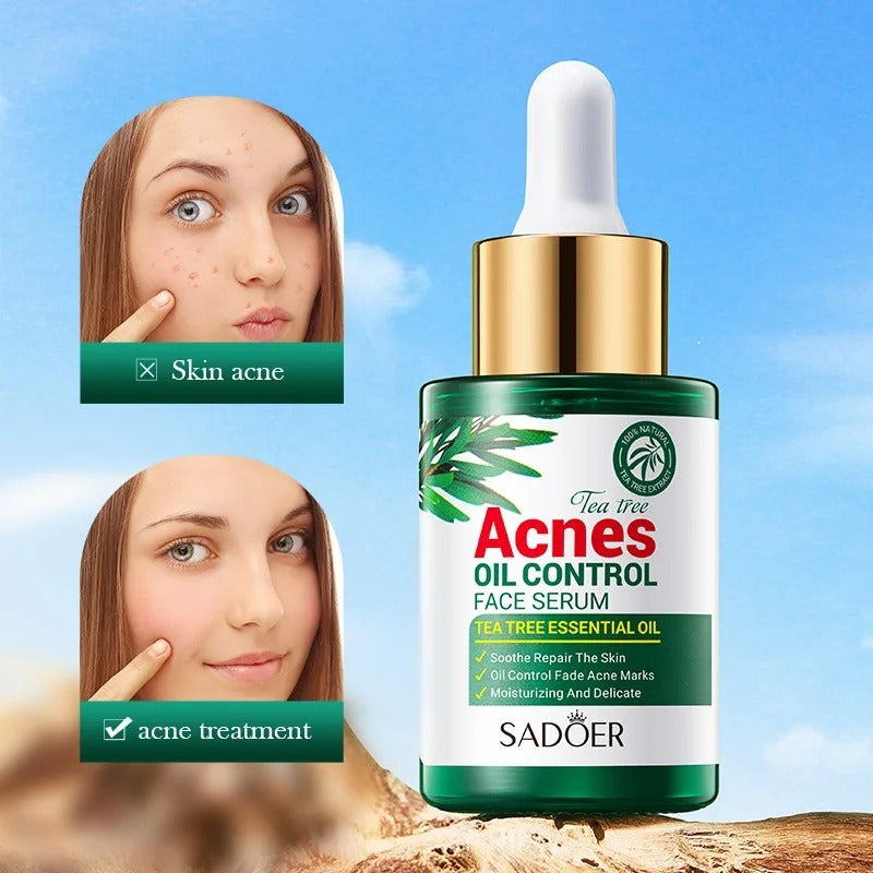 Tea Tree Hydrating Acne Control Oil