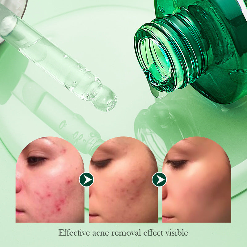 Tea Tree Hydrating Acne Control Oil