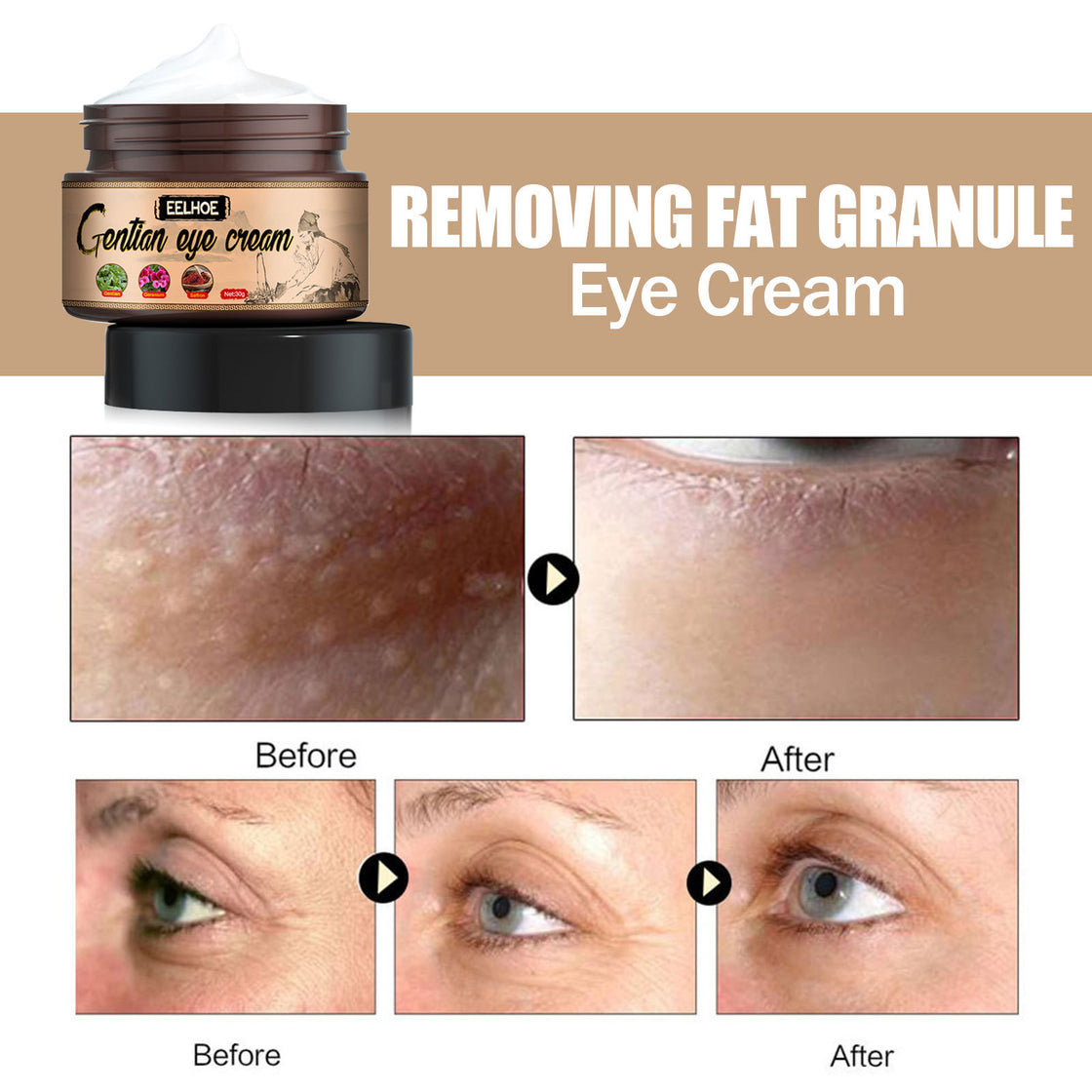Remove Fat Particles Moisturizing Eye Cream